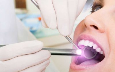 Stay Healthy, Know the Signs of Oral Cancer