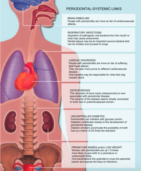 Bonner Method - IMPLANT PERIO CENTER