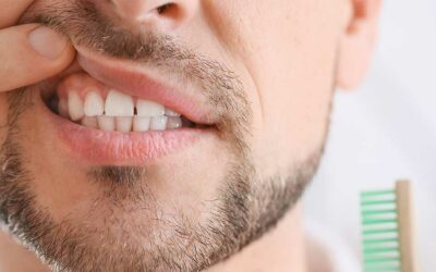 Itchy Gums: Symptoms, Causes, and Treatment